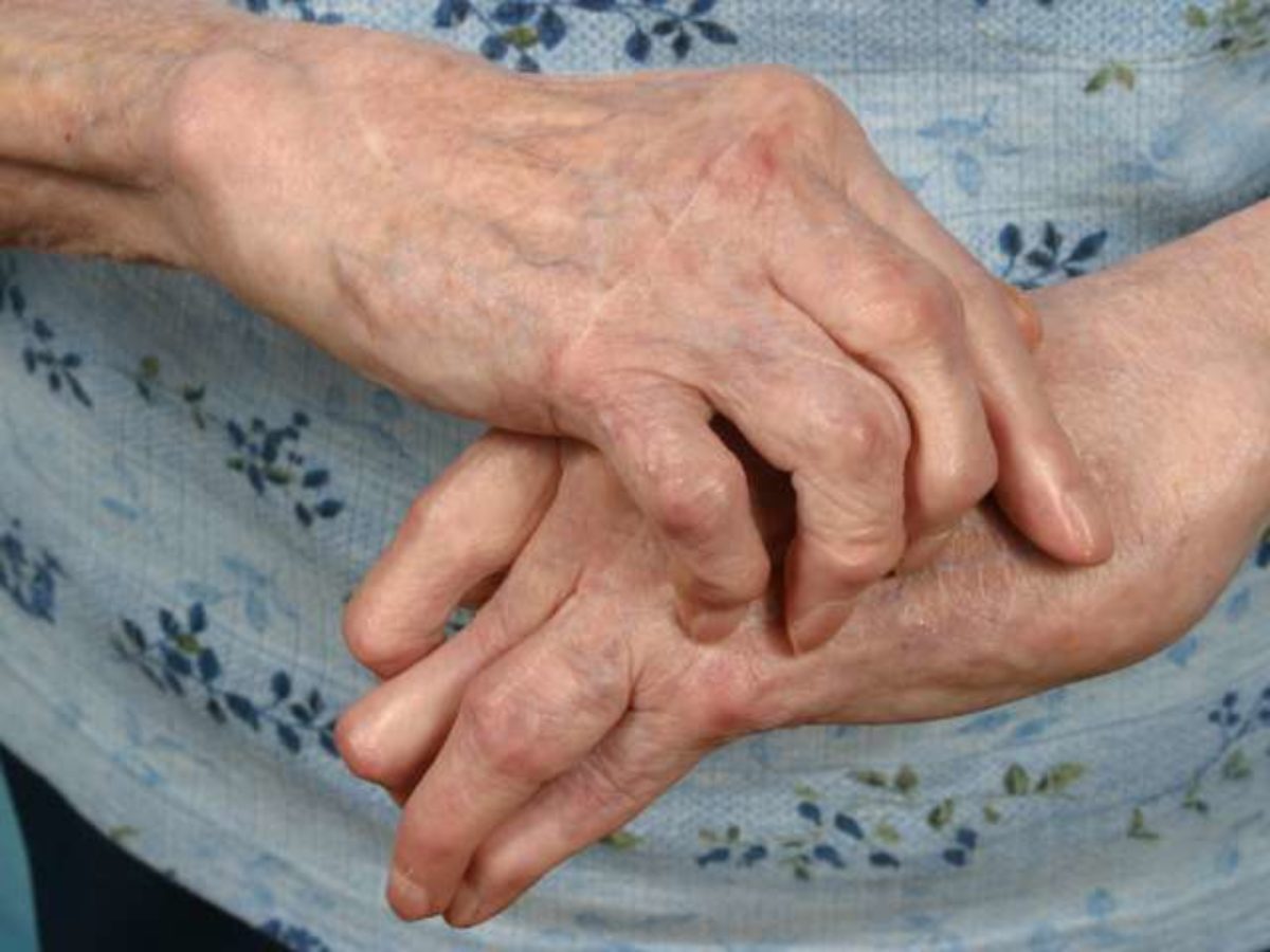 care este diferența dintre artroza și artrita mâinilor