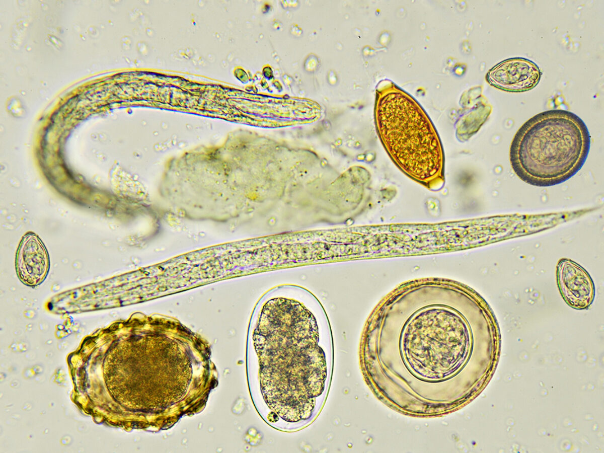 paraziti semne de tratament curățarea colonului detox acasă