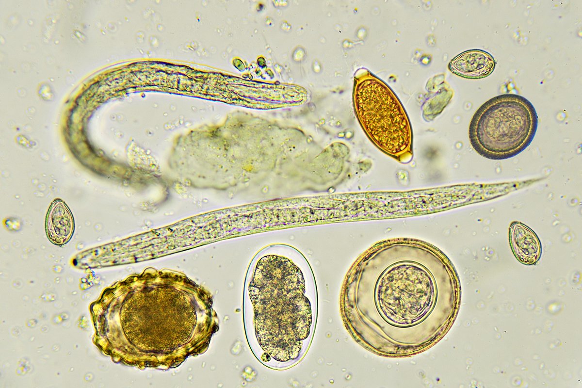 Paraziti Intestinali Tipuri Cauze Si Tratament NaturaMed