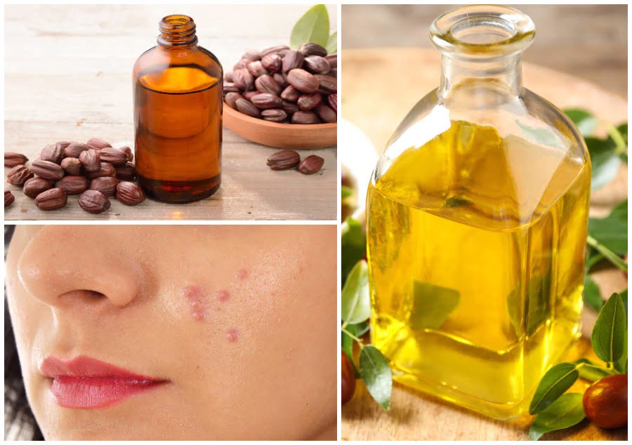 Cele mai uimitoare beneficii ale uleiului de jojoba pentru par si piele
