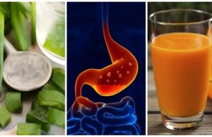 5 tratamente naturiste pentru refluxul acid